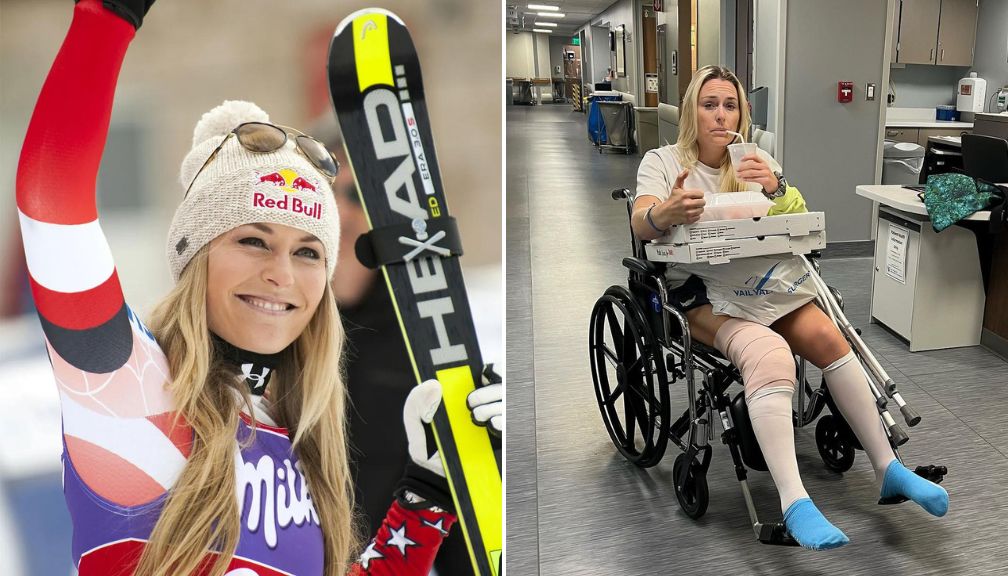 Lindsey Vonn Health Update: Fans Send Warm Wishes to US Olympic Star After Surgery